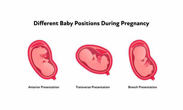 What Does Anterior Placenta Mean for Your Travel Through Pregnancy?