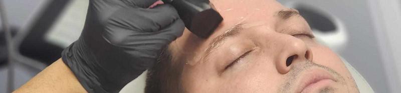 Forma Radiofrequency Treatment Cortlandt | Hudsonaestheticsmd.com