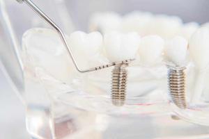 Dentist SEO Service: How Hyer Studios Helps Dental Practices Grow Online