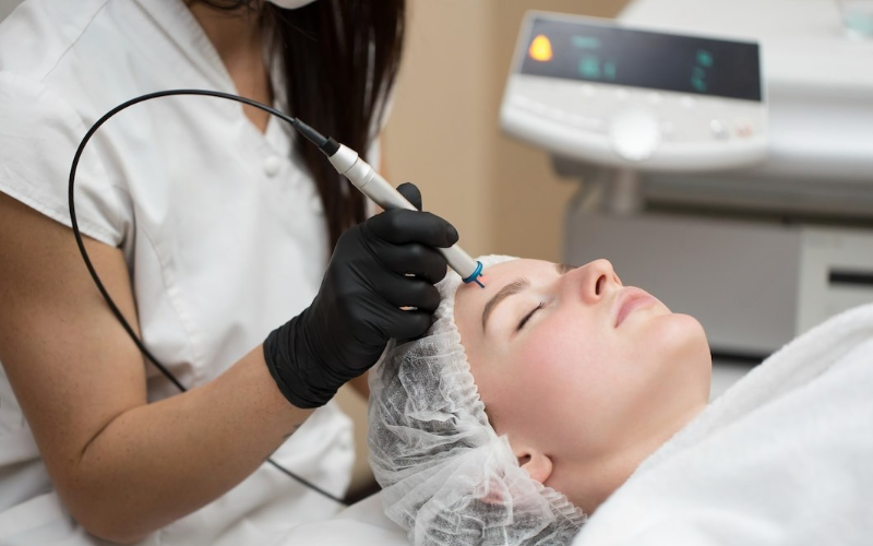 Why IPL Photofacial Is One of the Most Requested Skin Treatments Today
