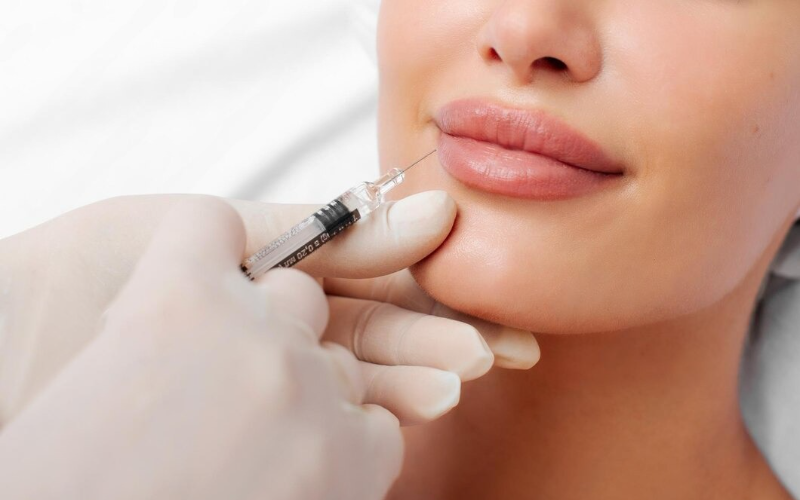 Achieve Soft, Natural-Looking Lips with Professional Lip Filler Services