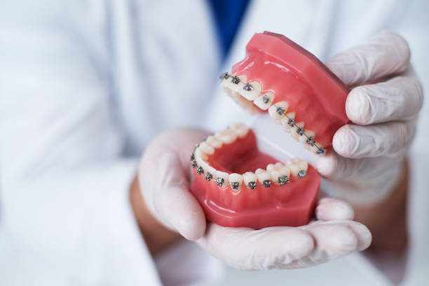 The Lasting Impact of Professional Orthodontic Care on Your Smile