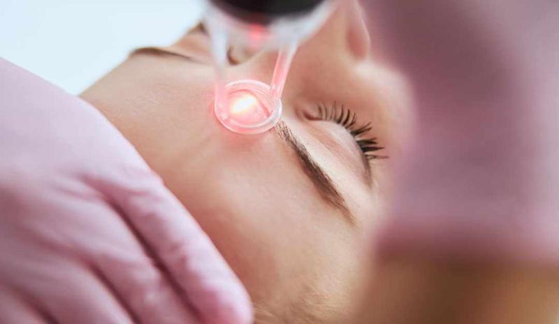 How To Prepare For Laser Skin Resurfacing Procedure?