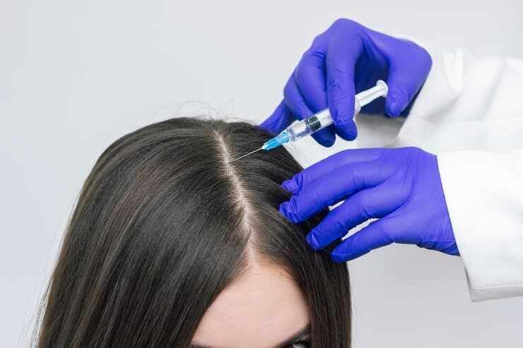 PRP for Hair Fall Treatment Benefits and Growth Cycle