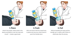 Anti Choke Device United Kingdom – Your Essential Safety Companion in 2025