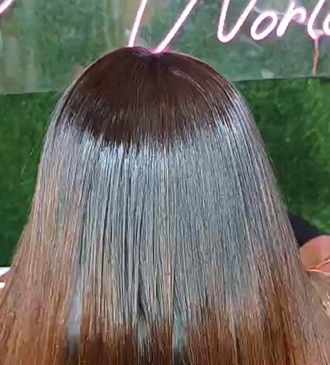 Why Nanoplastia Is Trending: Benefits, Process & Real Treatment Cost