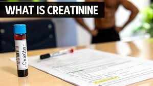 Level of Creatinine Requires Dialysis in the USA