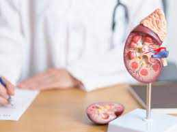 Best Ayurvedic Treatment for Kidney Diseases in USA