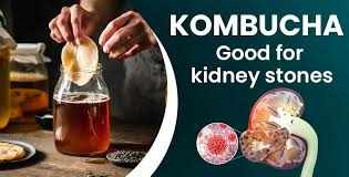 Is Kombucha Good for Kidney Stones
