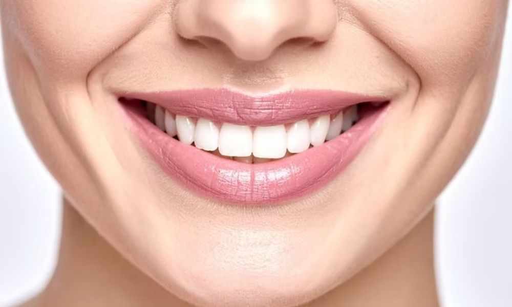 Do Teeth Whitening Treatments Work on Fillings? Understanding Their Effectiveness and Limitations