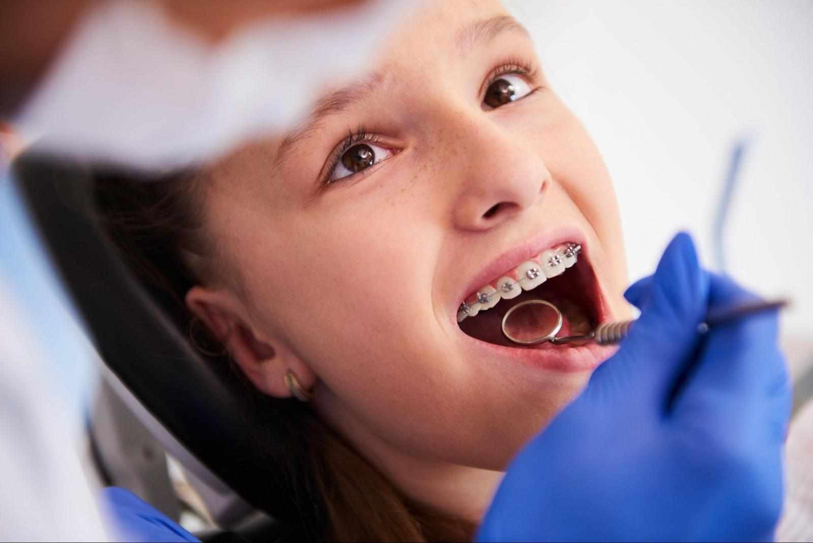10 Signs You May Need Braces Treatment for Better Oral Health