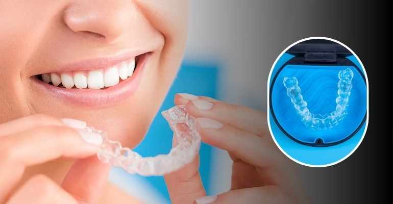 Top Questions to Ask Before Starting Invisalign Treatment