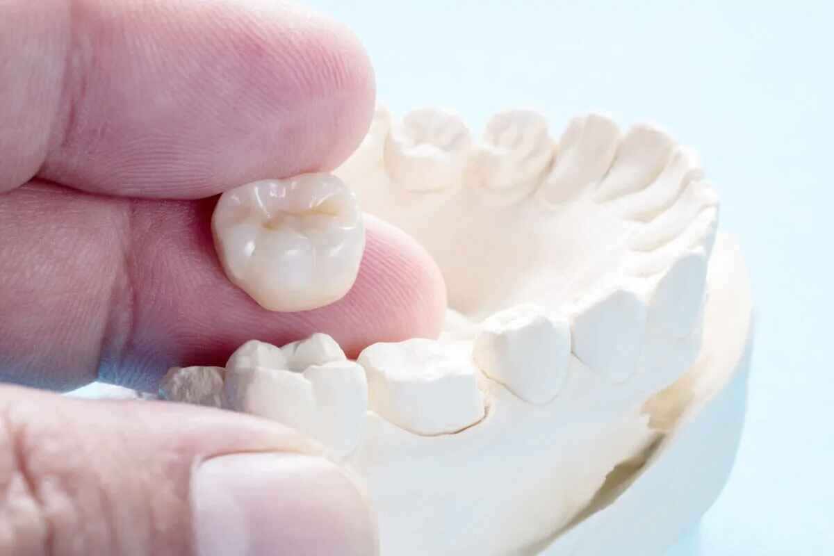 Teeth Scaling and Polishing Abu Dhabi: Keep Your Smile Healthy and Bright